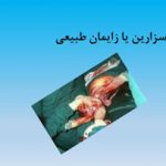 دانلود پاورپوینت سزارین یا زایمان طبیعی در ۱۲ اسلاید قابل ویرایش ⋆ فروشگاه فایل سیتیده